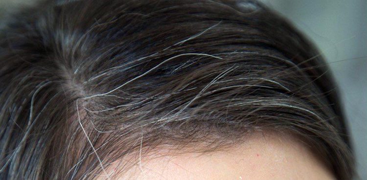 सिर के बाल वक्त से पहले हो जाते हैं सफेद? जानिए बचाव के उपाय