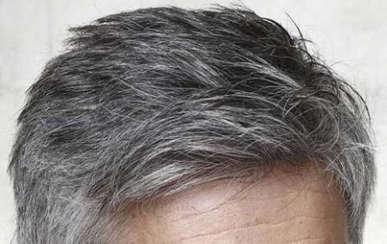 White Hair Treatment: सफेद बालों को करें आयुर्वेदिक तरीके से काला, जानें कैसे।