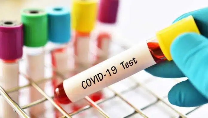 Fraud in the name of taking samples from home for the Covid-19 test