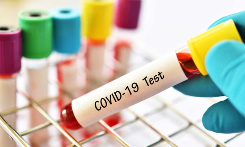 Fraud in the name of taking samples from home for the Covid-19 test