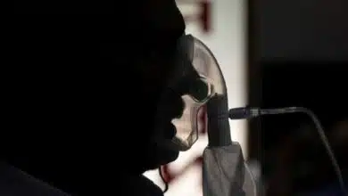 Uttar Pradesh will notify Black Fungus Disease