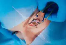 Increase in Black Fungus infection in Maharashtra