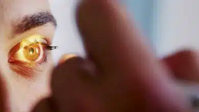 Jharkhand on high alert as the cases of Black Fungus increase