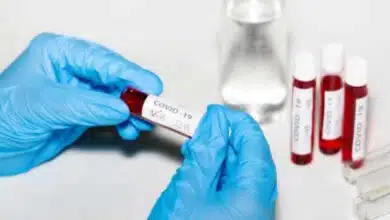 Lowest daily COVID cases in India in 2 months 2677 deaths in 24 hours