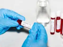 Maharashtra reports 10697 COVID-19 cases daily positivity rate at 4.79%
