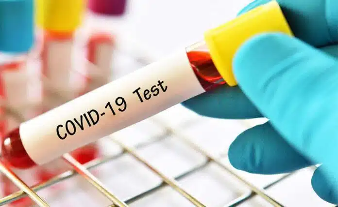 79 COVID-19 cases reported in Delhi, less than 100 cases for sixth consecutive day