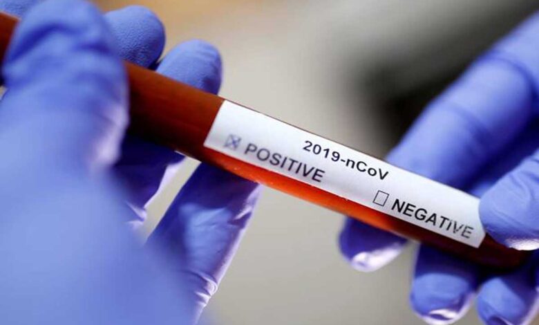 Delhi records less than 100 COVID-19 cases for the second day in a row