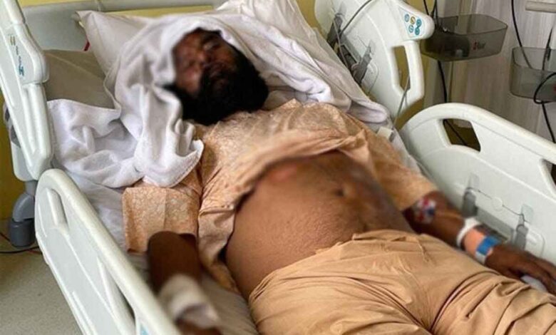 Lakhimpur Kheri violence: Minister Ajay Mishras son was in the car alleges injured farmer