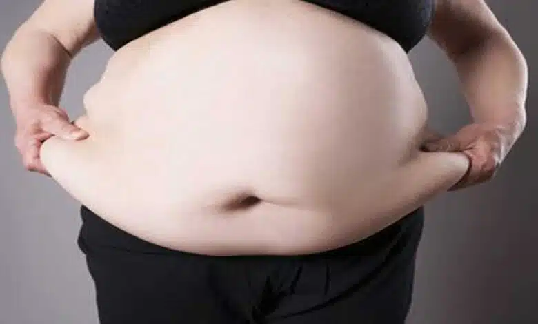 Is being overweight hindering your way of living?