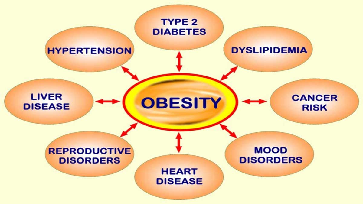 Overweight obesity 1 2 Is being overweight hindering your way of living?