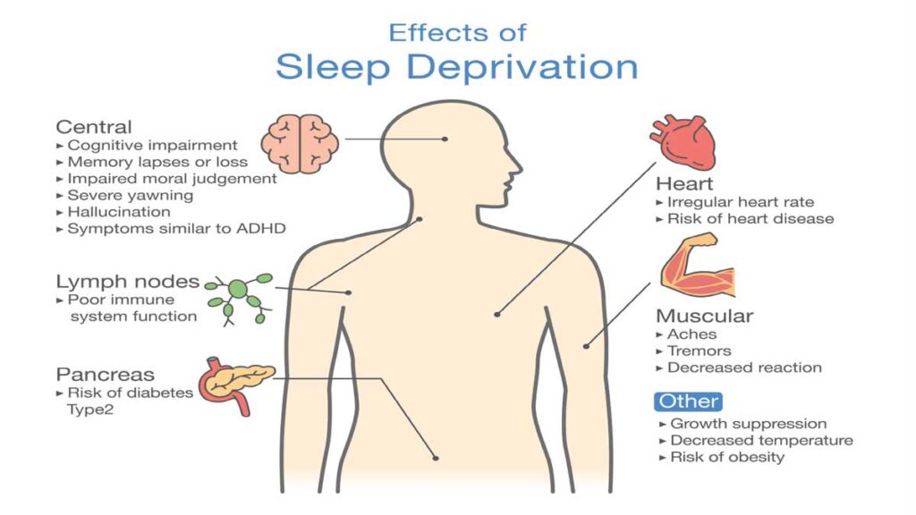 Sleep Deprivation is directly related to the weight increase