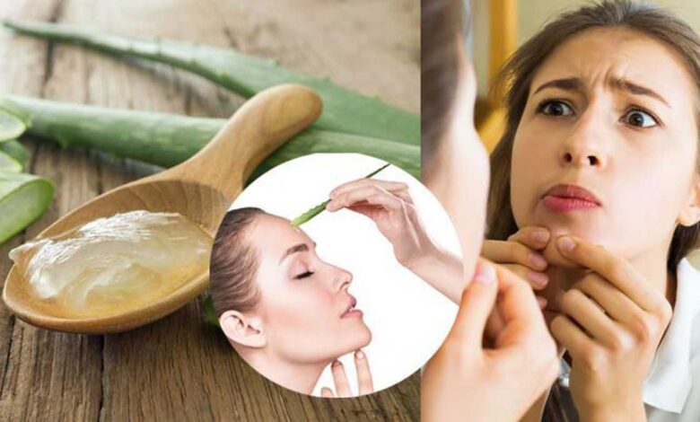 Herbal acne remedy for healthy skin