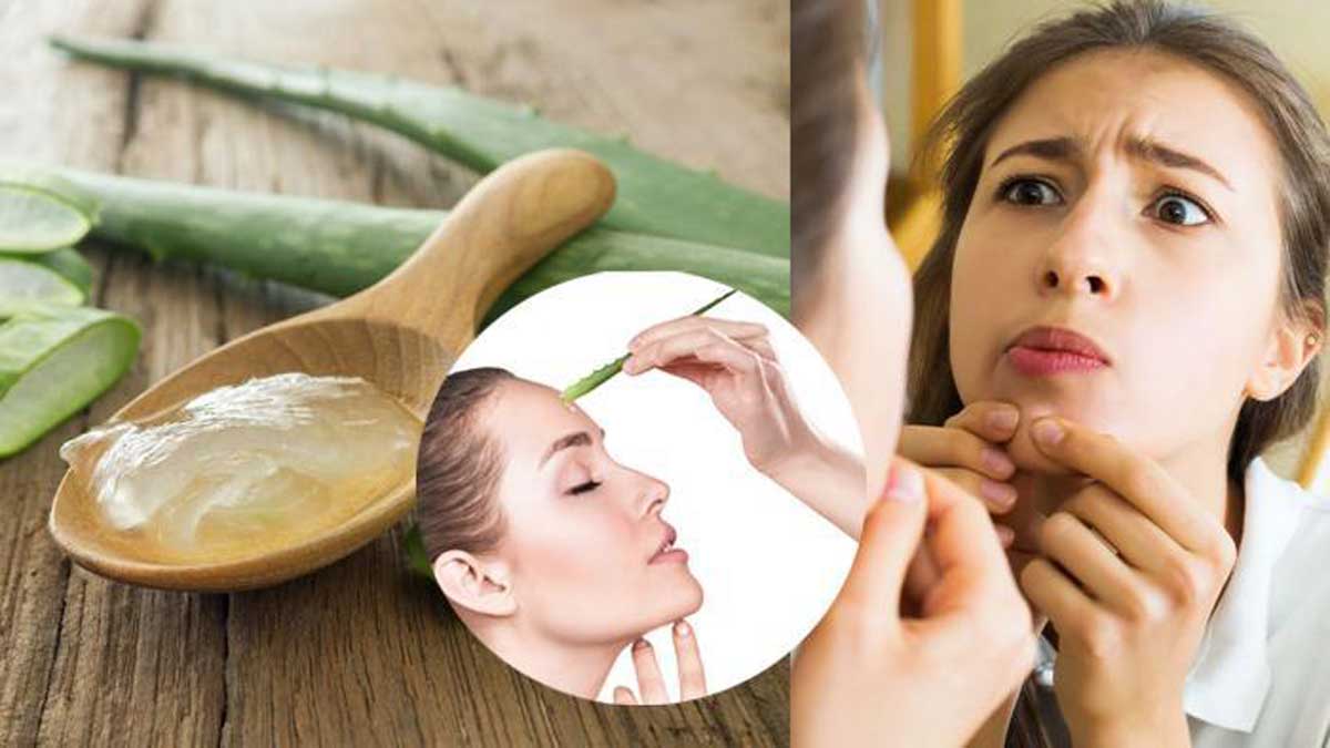 Herbal acne remedy for healthy skin