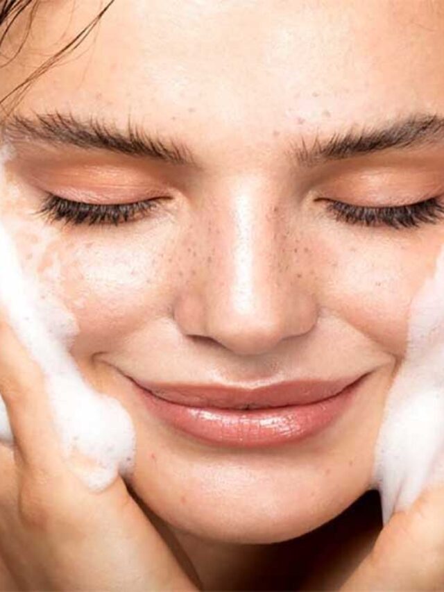 Acne को रोकने के लिए युक्तियाँ