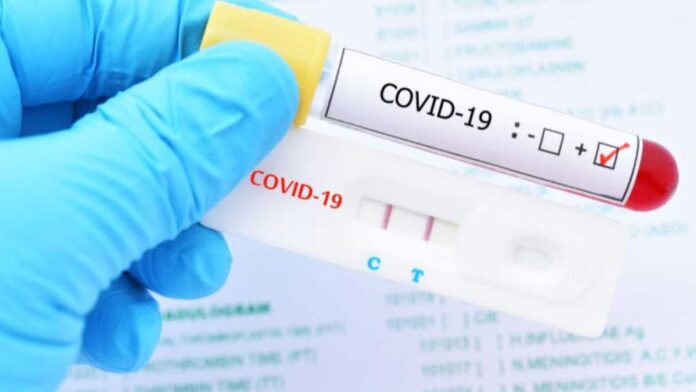 India reports 9,923 new COVID cases