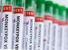 3 cases of monkeypox confirmed in Kerala