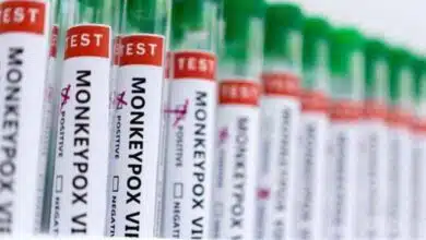 3 cases of monkeypox confirmed in Kerala