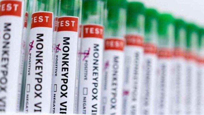 3 cases of monkeypox confirmed in Kerala