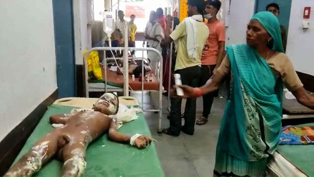 3 children scorched after cylinder fire in Budaun