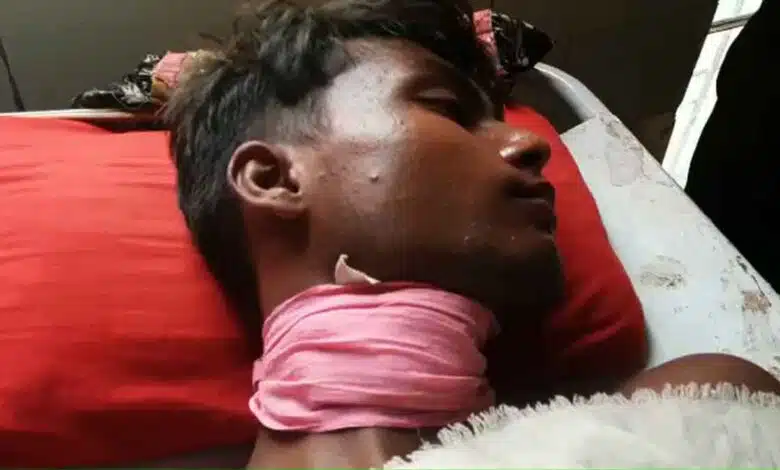 Hardoi Pregnant girl accused of slitting her boyfriend's throat