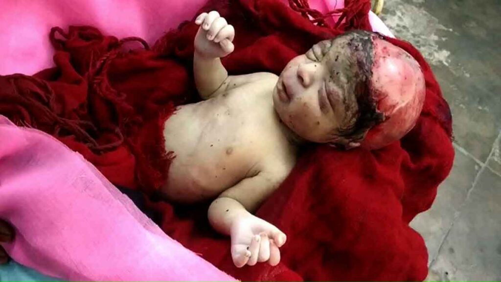 Newborn girl thrown in the Bulandshahr field