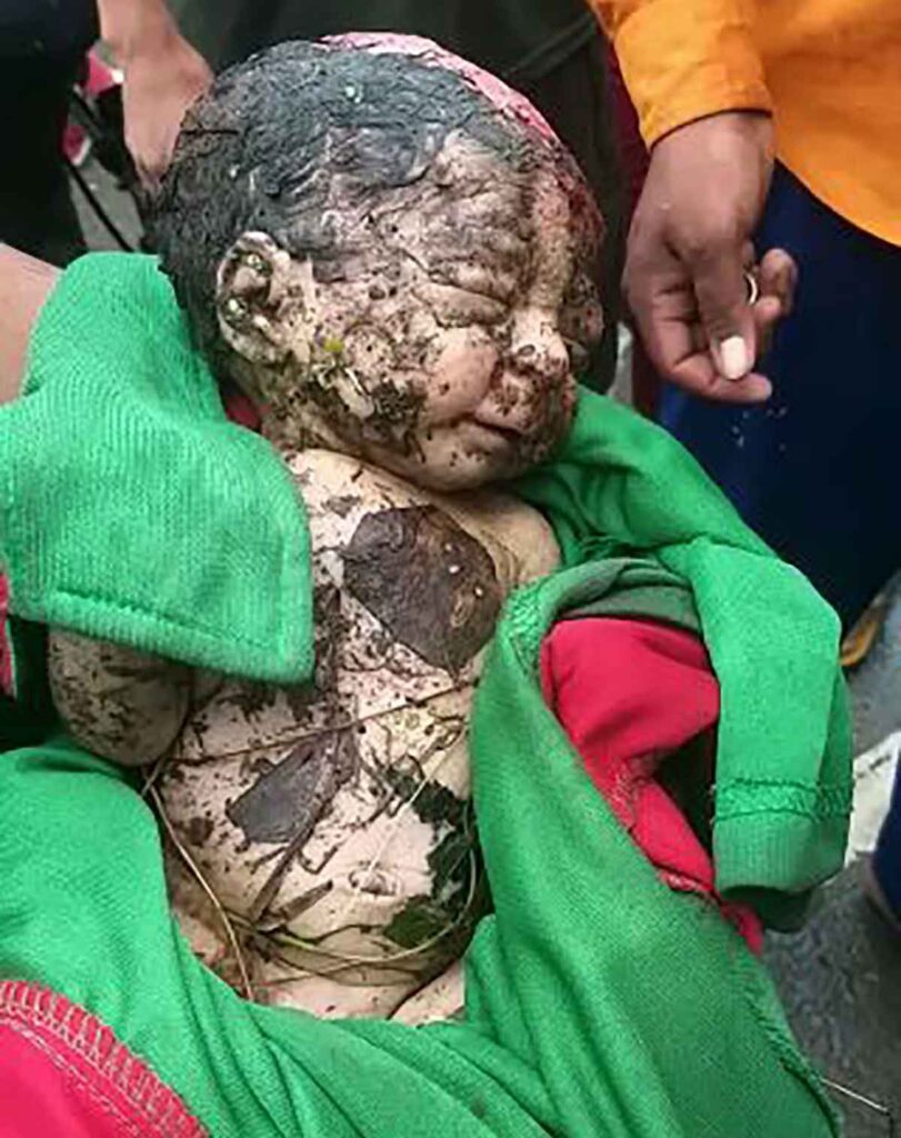Newborn girl thrown in the Bulandshahr field