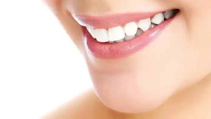 7 Home Remedies for Teeth Whitening