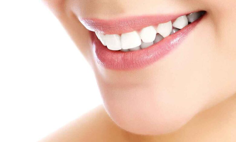 7 Home Remedies for Teeth Whitening