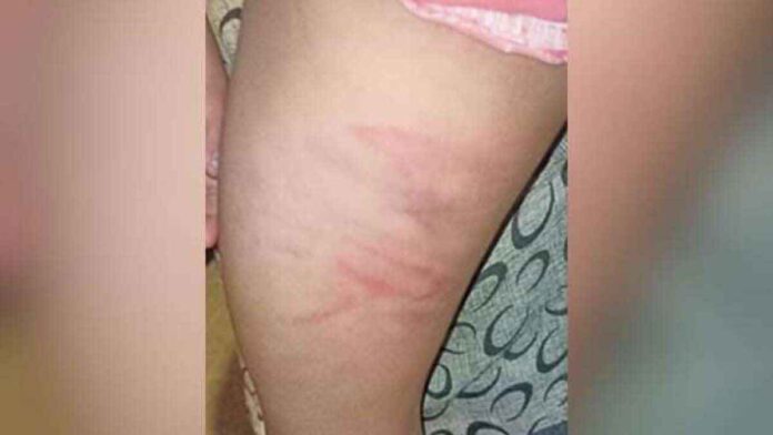 6 and 8 year old sisters were beaten by delhi tutor
