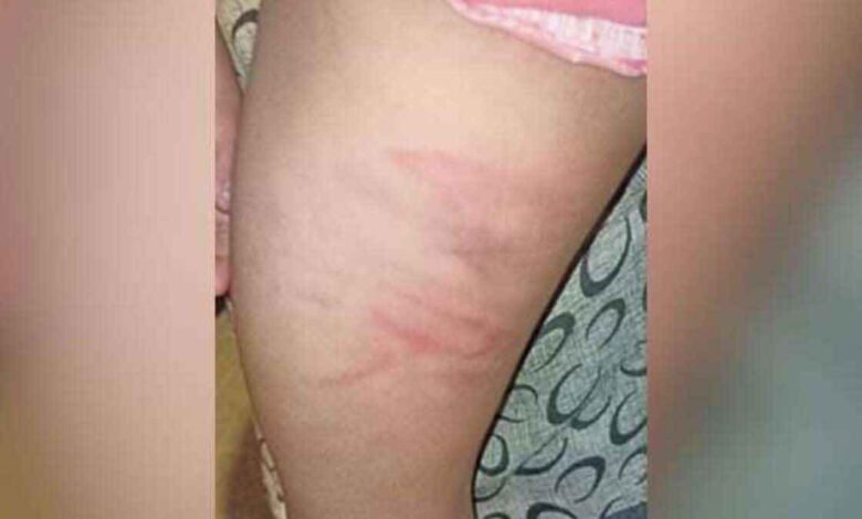 6 and 8 year old sisters were beaten by delhi tutor