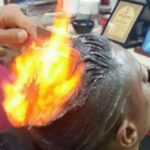 Teenager burns in Gujarat due to 'fire haircut' failure