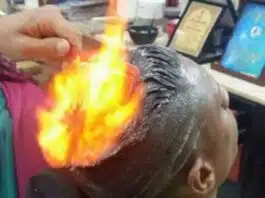 Teenager burns in Gujarat due to 'fire haircut' failure