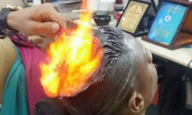 Teenager burns in Gujarat due to 'fire haircut' failure