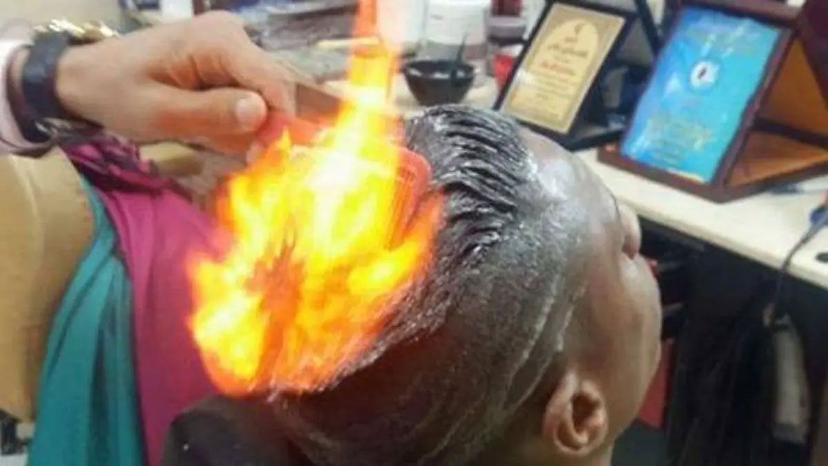 Teenager burns in Gujarat due to 'fire haircut' failure