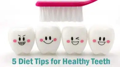 5 Diet Tips for Healthy Teeth