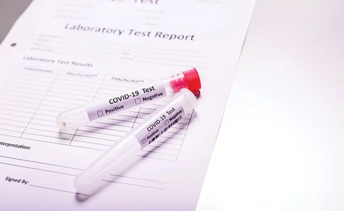 Negative Covid report is necessary coming to India