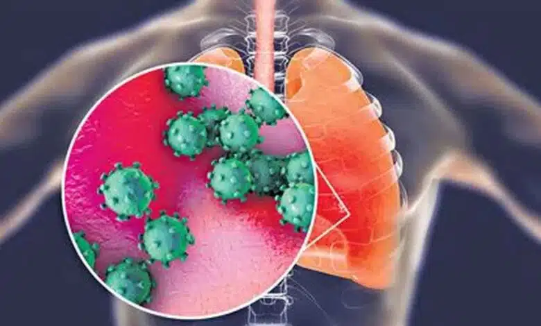 India's first H3N2 Influenza death