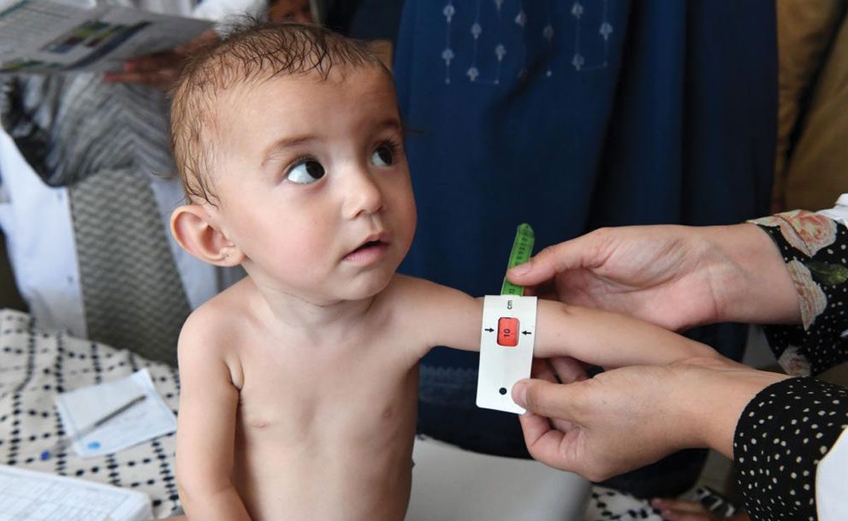 Malnutrition Malnutrition among Maharashtra children improves