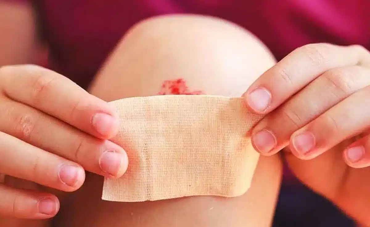 treatment of wounds and injuries Use of Remaining Tea Leaves