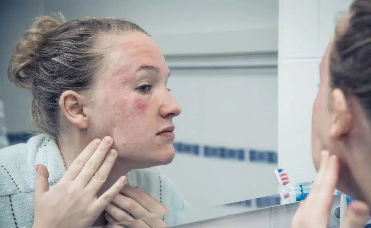 Ice water facial can spoil the texture of the skin, be careful