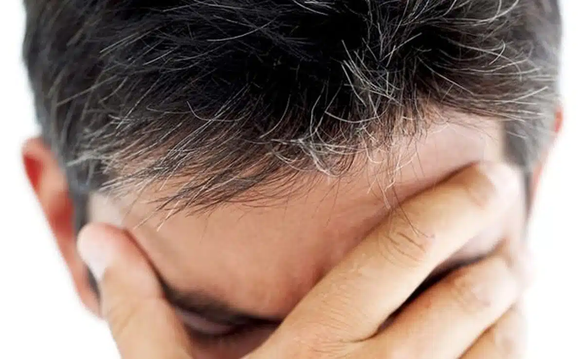 Causes and Natural Remedies for White Hair