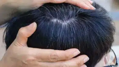 Causes and Natural Remedies for White Hair