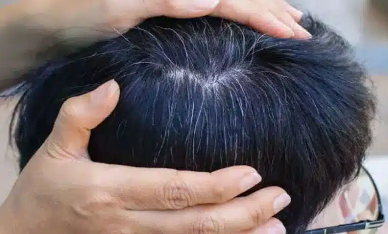 Causes and Natural Remedies for White Hair