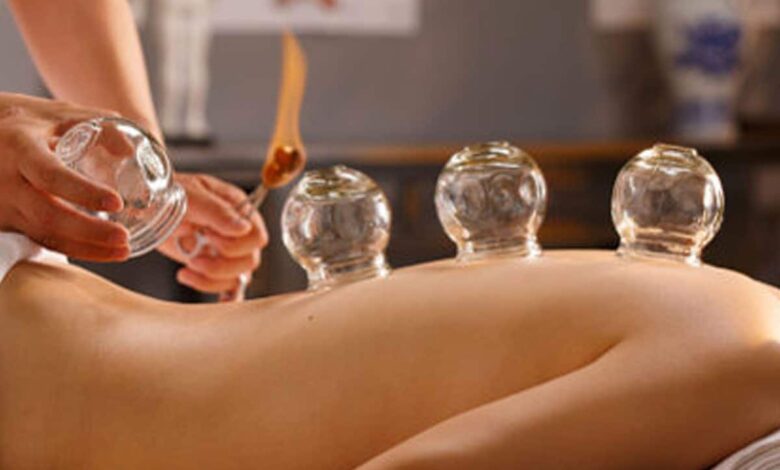 Important thing related to cupping therapy