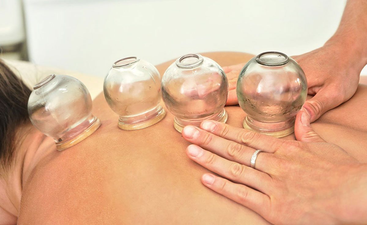 Important thing related to cupping therapy