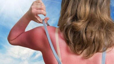 Some ways to avoid sunburn
