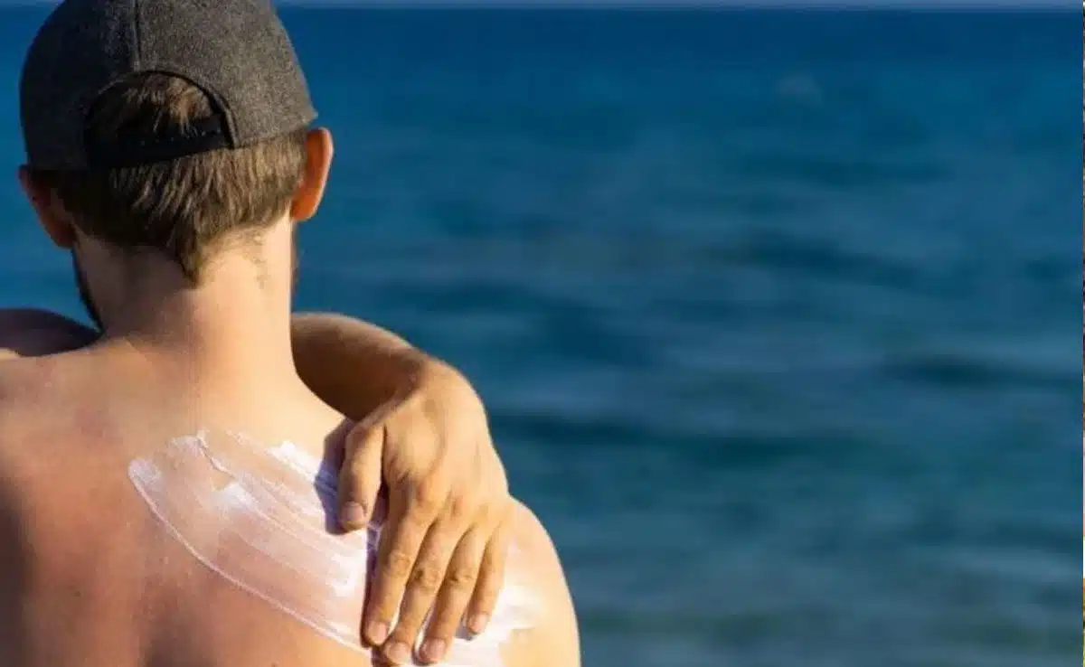 Some ways to avoid sunburn