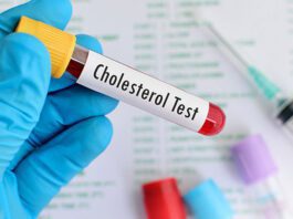 Foods that harm or benefit cholesterol
