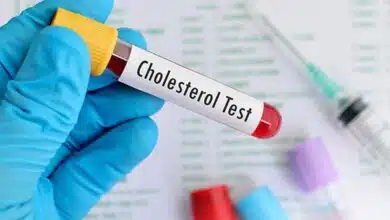 Foods that harm or benefit cholesterol