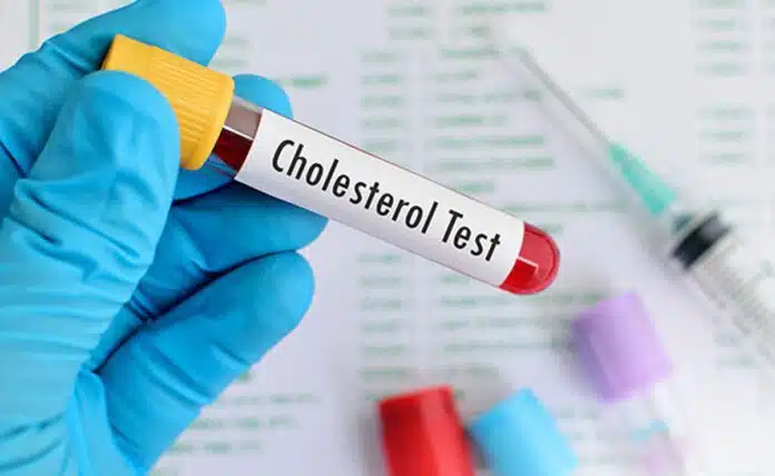 Foods that harm or benefit cholesterol